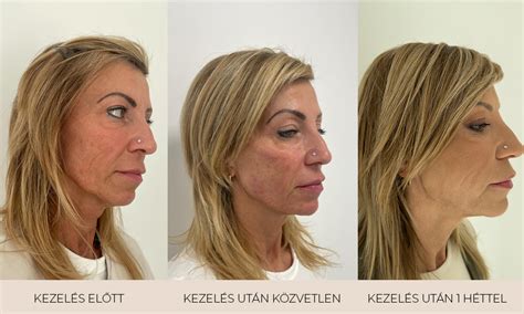 osszehasonlitas elotte-utana sminkes kepszerkesztes utan