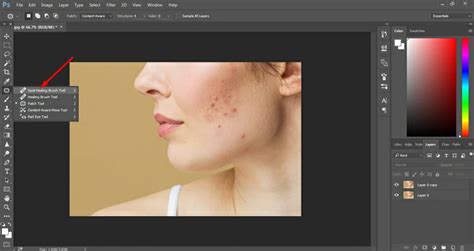 Content-Aware Spot Healing Brush használata