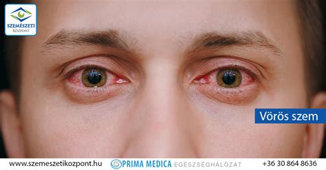 Összehasonlítás: Vörös szem eltávolítása előtt és után