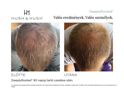 Képmanipuláció előtte-utána