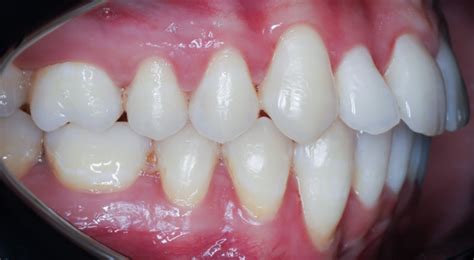 Példa a retusálás előtte-utána hatásaira